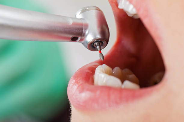 Best Emergency Dental Care for Abscessed Tooth in St Marys, KS